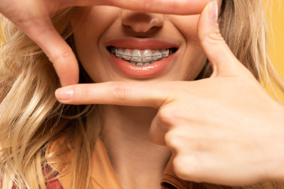 Mujer sonriendo con brackets dentales